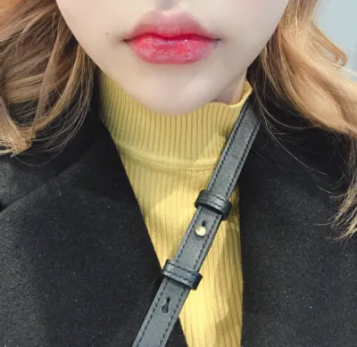 [微整形] 앙홈런볼 - 嘴唇填充、肉毒桿菌