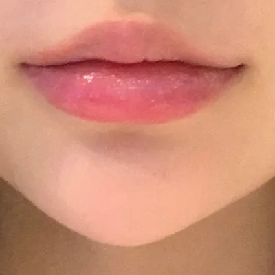 [微整形] 갸냐뇨뉴 - 嘴唇、下巴