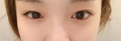 [眼睛] 藍熊貓 - 眼睛