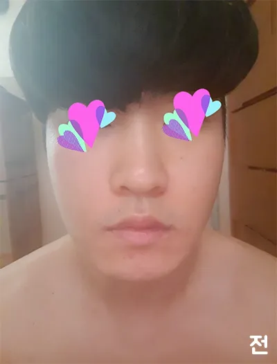 [皮膚] 很容易 - 音波拉提