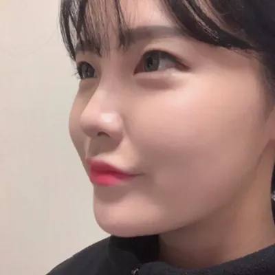 [微整] 性順伊人 - 鼻子