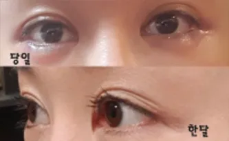 [眼部] 별별별18 - 眼部