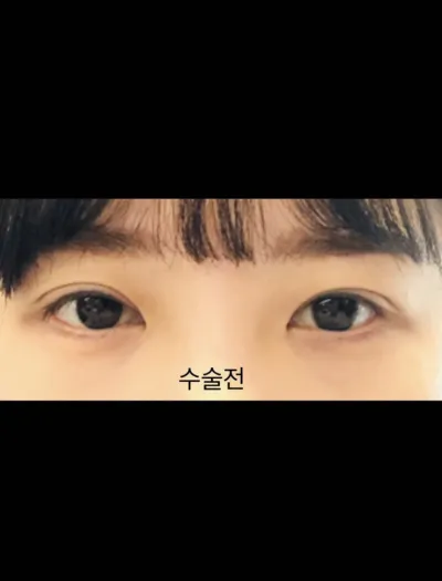 [眼睛] 주히95 - 眼睛