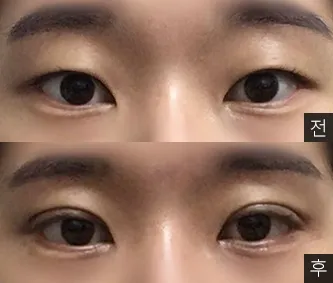 [眼睛] 구름이맑음 - 眼睛