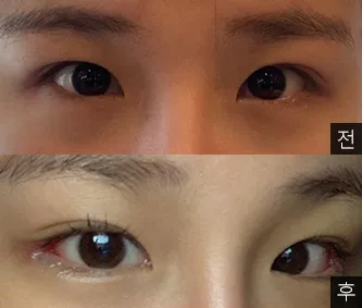 [眼睛] Darlyjjangee 姊姊 - 眼睛