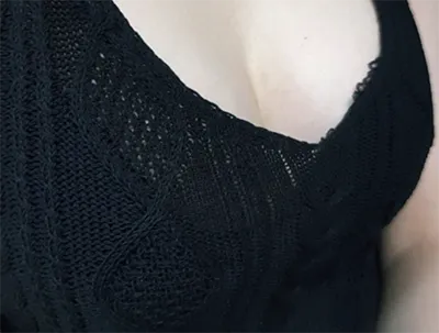 [隆胸] 지엄 - 隆胸