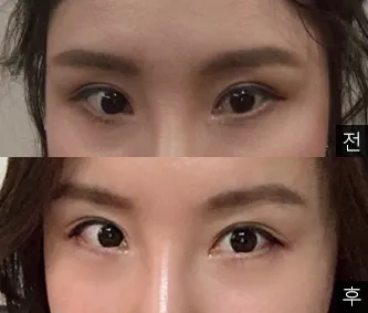 [眼睛] 萊萊萊 - 眼睛