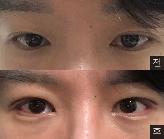 [眼睛] 窗邊李 - 眼睛