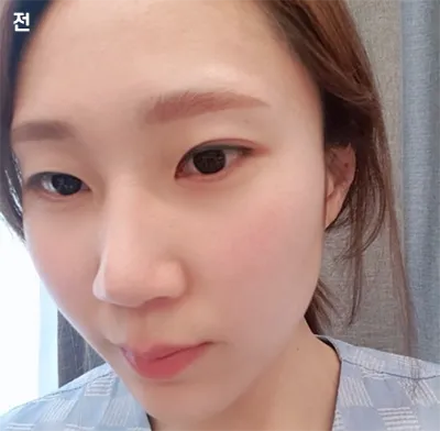 [眼睛] jipoi - 眼睛