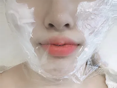 [皮膚] ㅁㅋㅌㅇㅎㅅ - 音波拉提、輪廓肉毒