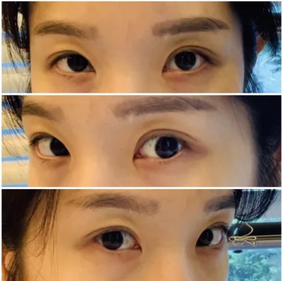 [眼睛] 따딴블리 - 開眼頭、開眼尾