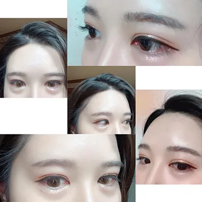 [眼睛] sjsi2 - 眼睛