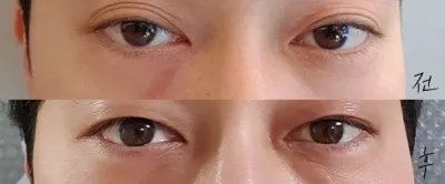 [眼睛] 彈力可愛 - 眼睛