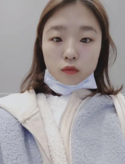 [微整形] 힁홍행 - 眼下、肉毒桿菌、填充