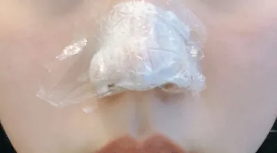 [微整形] Frurie - 肉毒桿菌, 鼻尖