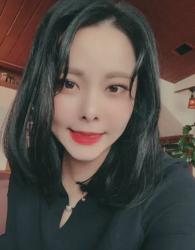 [眼部] songi1938 - 後眼角切開、下眼瞼下至