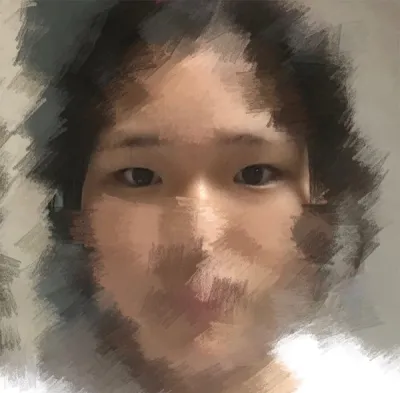 [眼部] 鄭藝瑟 - 開眼頭、眼型矯正