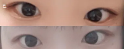 [眼睛] 我是申恩瑞 - 眼睛