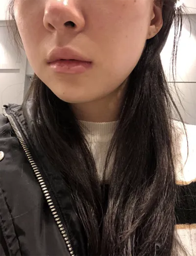 [皮膚] Hanhaneung - 音波拉提