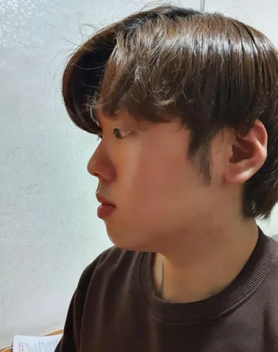 [男性] 浮腫浮腫 - 眼睛、鼻子