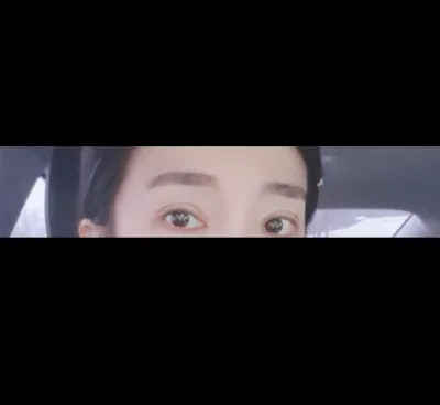 [眼睛] Half-Baff - 眼睛重修手術