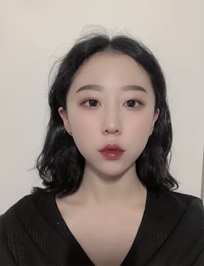 [微整形] 夜晚的芒果冰沙 - 肉毒桿菌、玻尿酸填充