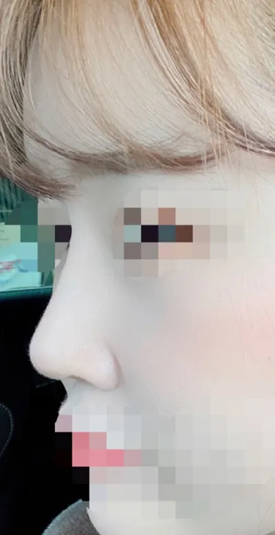 [鼻部] Shav - 鼻部