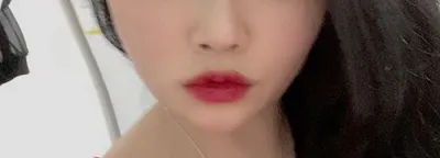 [皮膚] s素妍s - 音波拉提、香奈兒注射