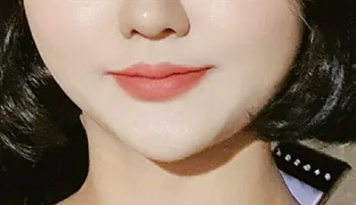 [微整] 다니륭 - 輪廓針、下巴肉毒