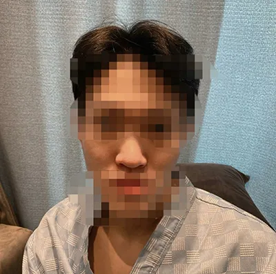 [鼻] 蚯蚓2@ - 鼻