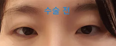 [眼睛] 一次到位 - 眼睛