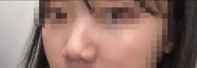 [鼻] 請問為什麼不接電話 - 鼻