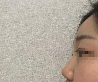 [眼睛] wlswn1 - 鼻子