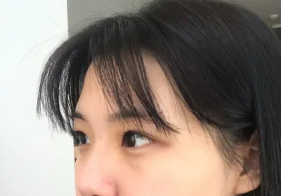 [眼睛] 嚶啊嚶 - 雙眼皮(自然黏連), 上眼瞼提拉