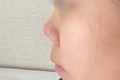 [鼻] 全智賢2 - 鼻樑