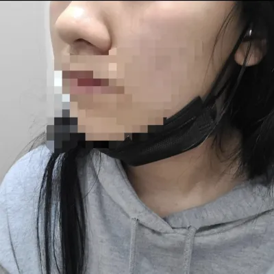 [鼻] 準備開始 - 鼻