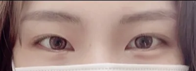 [眼睛] itxufx - 上眼瞼下至、下眼瞼下至