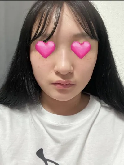 [鼻] 밍카인 - 鼻