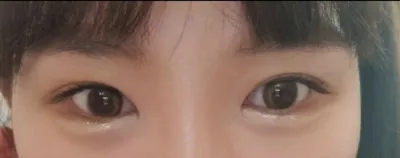 [眼睛] 징필리우스 - 眼睛