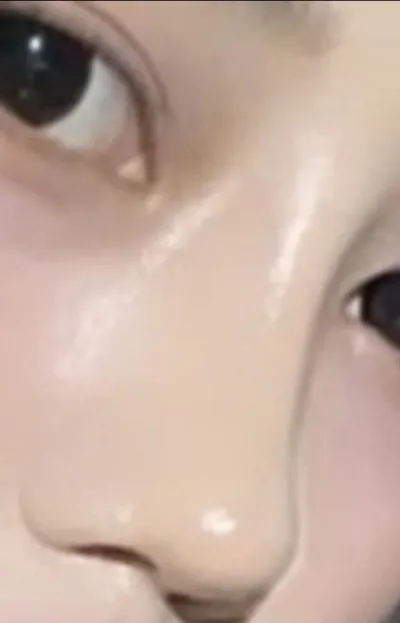 [鼻] Merong Mango - 鼻