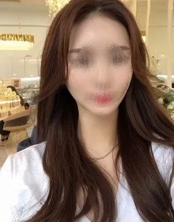 [顏面輪廓] JOY - 輪廓