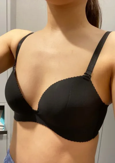 [隆胸] Lily - 隆胸