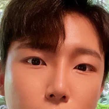 [男性] Aiden - 縫雙眼皮, 眼下脂肪重新配置, 隆鼻