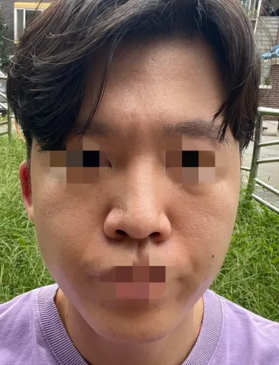 [男生] 조앤 - 鼻子、輪廓