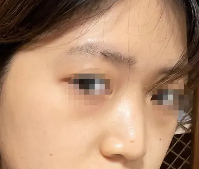 [眼睛] Sunde Della - 眼睛、鼻子