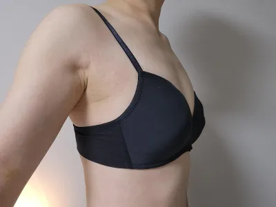 [隆胸] Monogram - 胸部