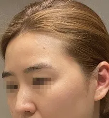 [鼻] 옥탑방고양이 - 鼻