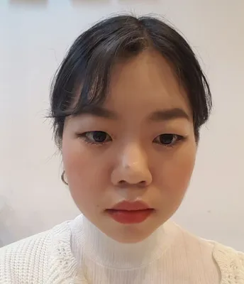 [鼻] 海鷗線 - 眼、鼻