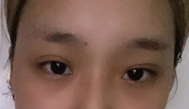 [鼻部] Melody - 輪廓、眼睛、鼻子