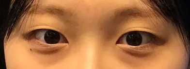 [眼睛] 可口可樂 - 眼睛